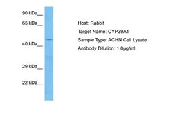 CYP39A1 Rabbit anti-Human, Polyclonal, Novus Biologicals 0.1 mL | Buy Online | Novus Biologicals | Fisher Scientific